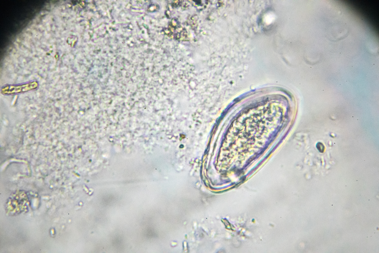 Яйца остриц микроскопия